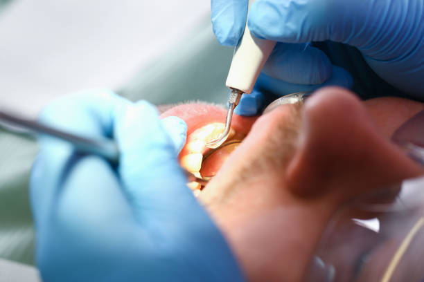 Best Emergency Denture Repair in Rossmoor, CA